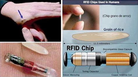 don't get an rfid chip|rfid microchips.